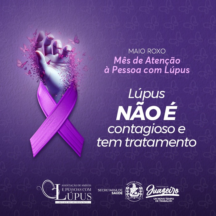 Maio Roxo: Prefeitura de Juazeiro conscientiza sobre Lúpus e divulga assistência em saúde para pacientes do municípios