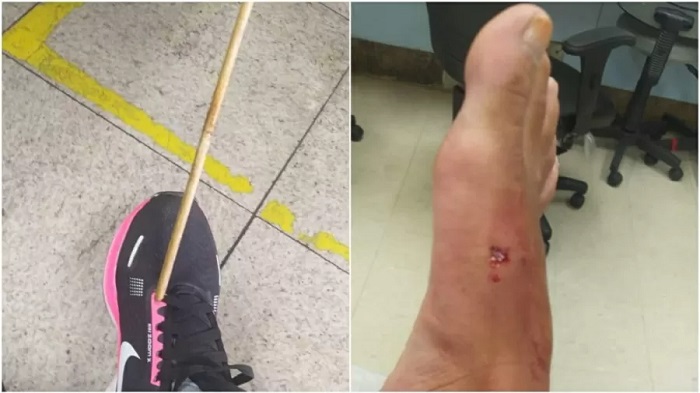 Mulher é atingida por flecha de 60 cm no pé em Belo Horizonte